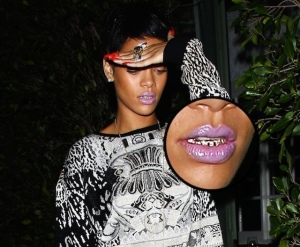I'm sorry, but the whole gold teeth thing (real of not), is VERY ratchet